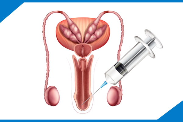 Erectile Dysfunction